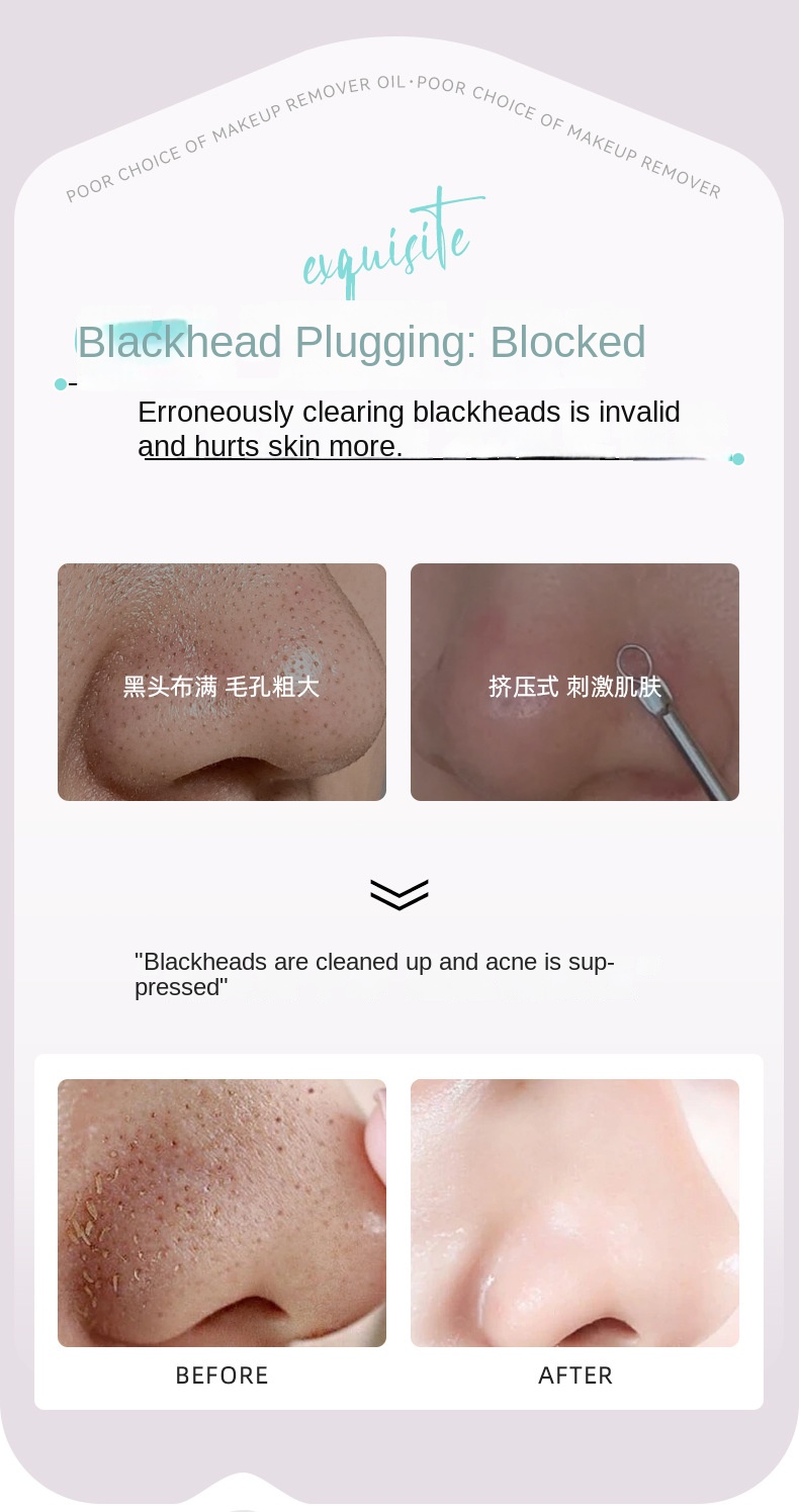 Charcoal Plant Extract Blackhead Suction Nose Mask Set